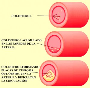 colesterol3